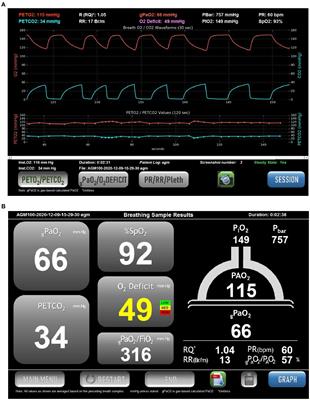 Non-invasive Measurement of Pulmonary Gas Exchange Efficiency: The Oxygen Deficit